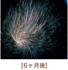 6ヵ月後